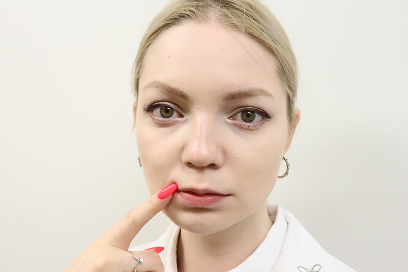口の中の歯周病を気にする女性