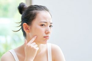 ストレスで肌に悩みのある女性