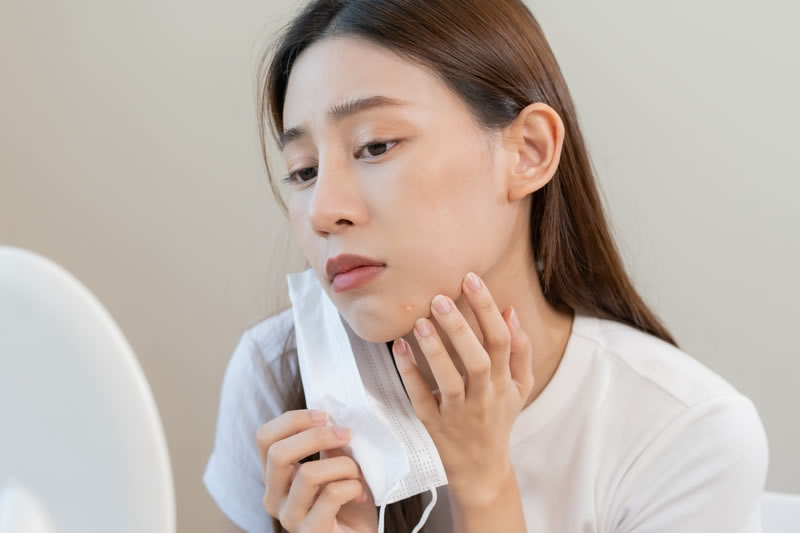 マスクの肌荒れに悩む女性