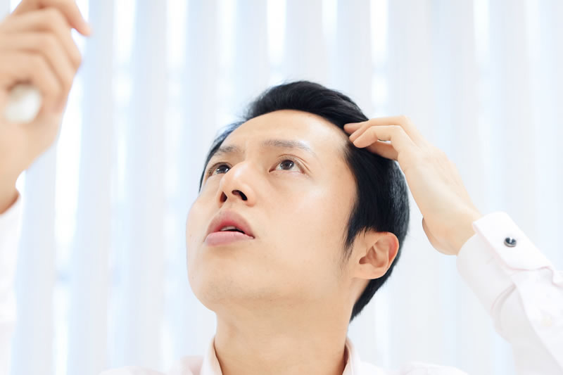 AGAに悩んでいる男性