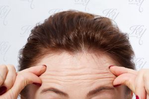 おでこのしわが気になる女性