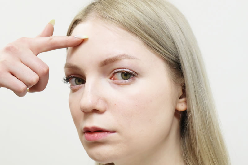 おでこの美容整形をする理由について解説する看護師