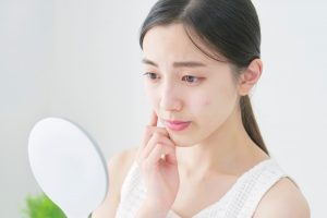 ニキビに悩む女性