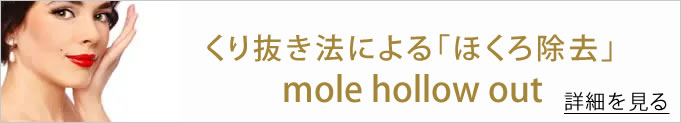 くり抜き法によるほくろ除去へのバナー