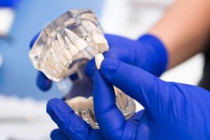 セラミック治療について解説する歯科医