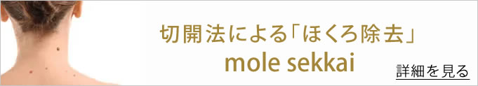 切開法による「ほくろ除去」へのバナー