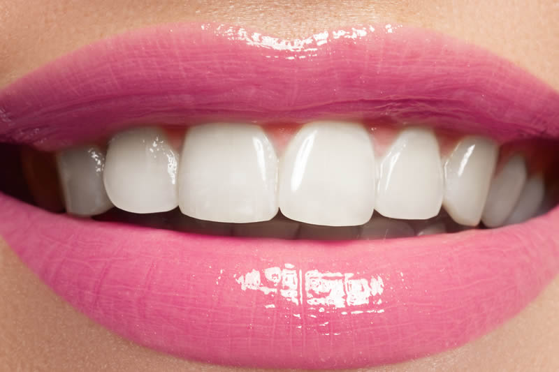 白い歯