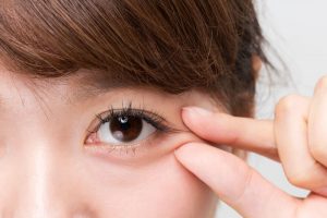 目元のしわがきになる女性
