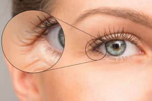 目元のしわが気になる女性