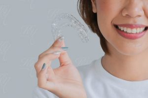 マウスピース矯正を手に持ってる女性