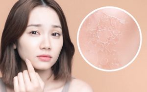 乾燥肌の女性のイメージ