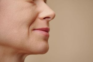 ほうれい線に悩む女性