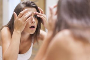 ニキビが気になる女性