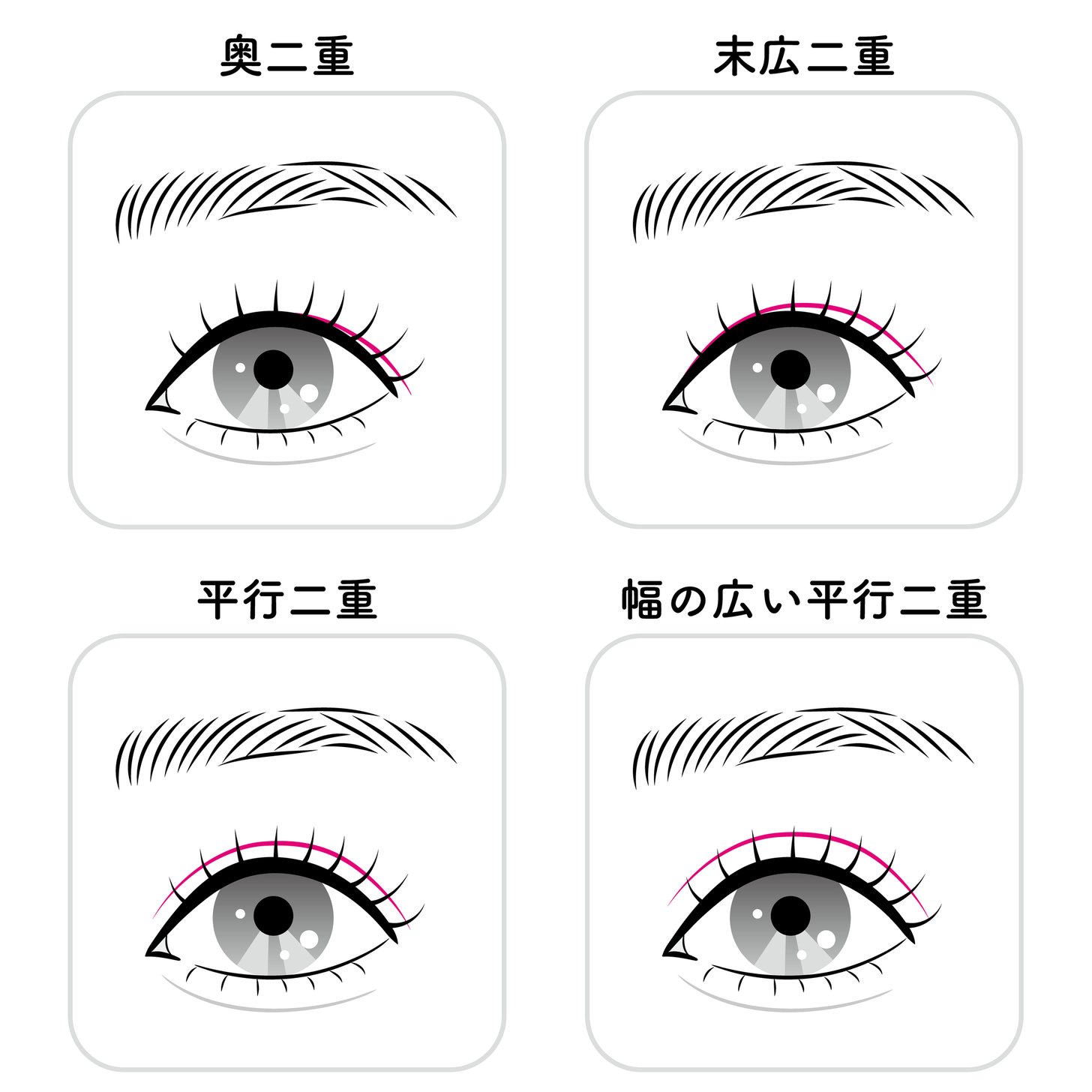 奥二重・末広二重・平行二重・幅の広い平行二重を比較した二重の種類の図解