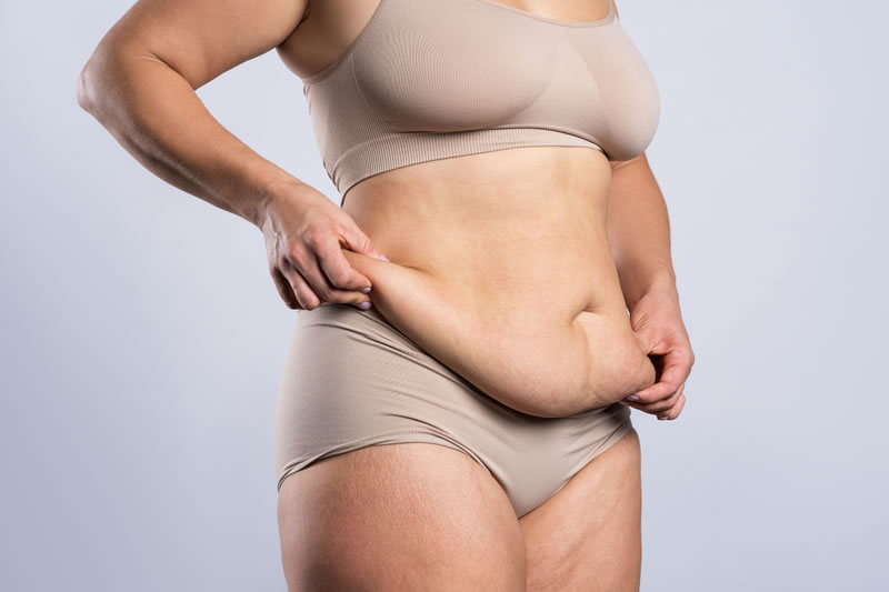 お腹の皮膚がたるんでしまった女性