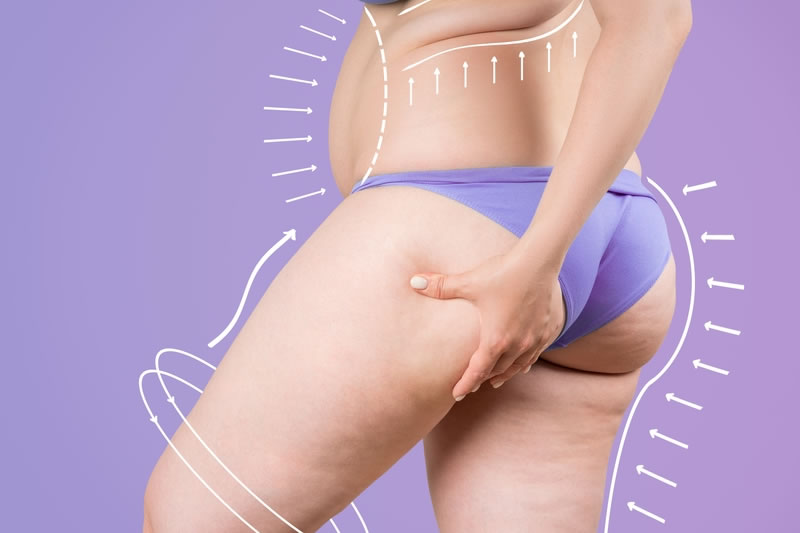 太ももの脂肪が気になる女性