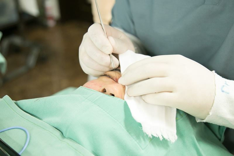 全切開の手術をしているところ