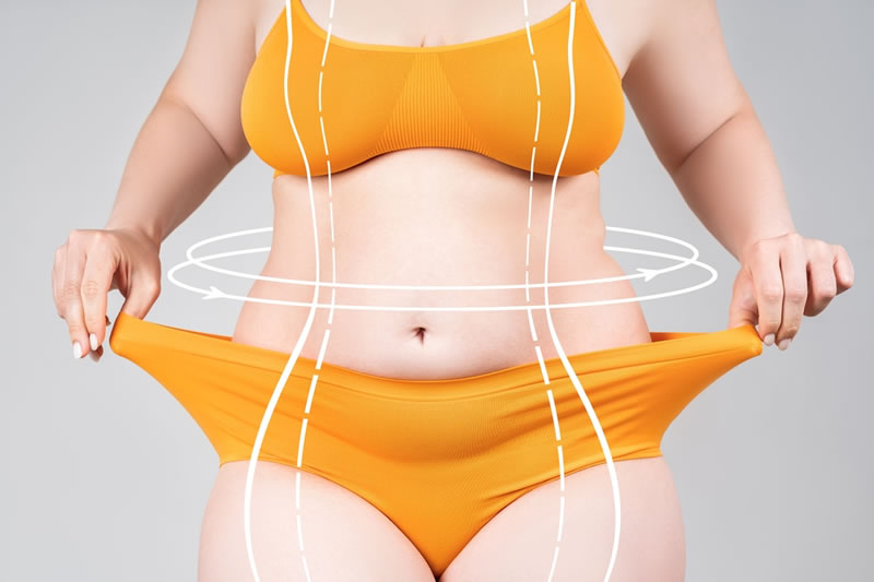 脂肪吸引のダウンタイムとは？大阪でのクリニック選びのポイントも解説！