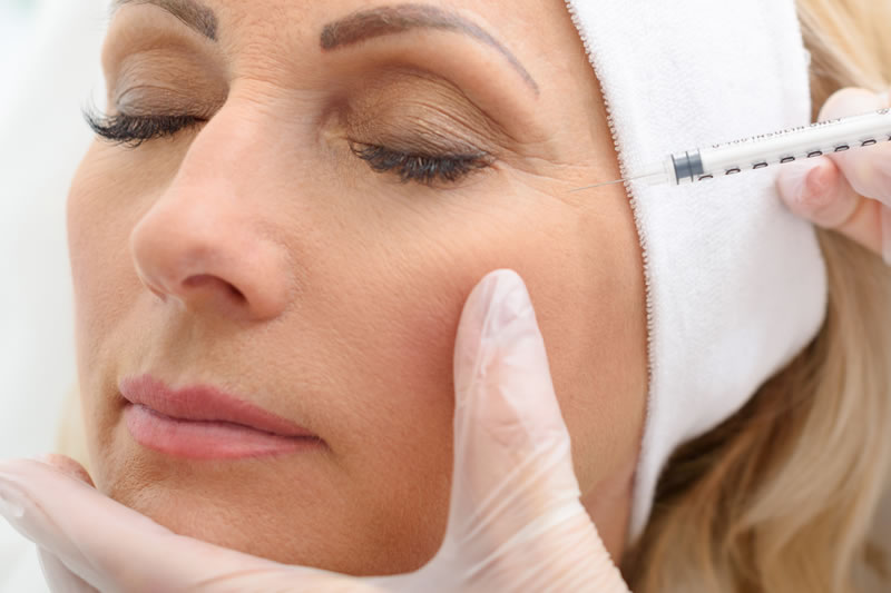 ボトックス注射を受ける女性