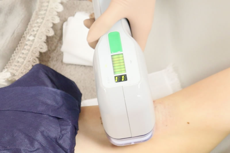 脇にマイクロ波を照射しているところ