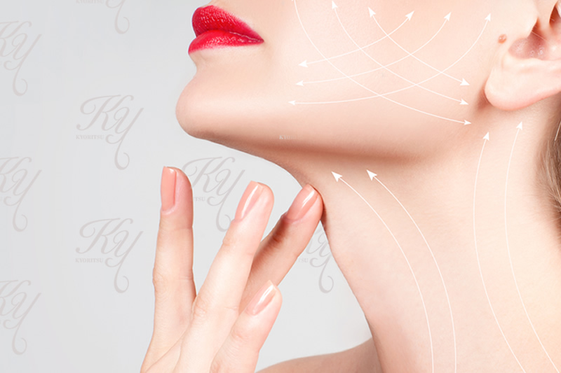 リフトアップのイメージ