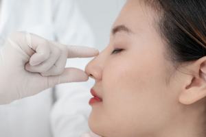 鼻尖形成の手術をする前の女性