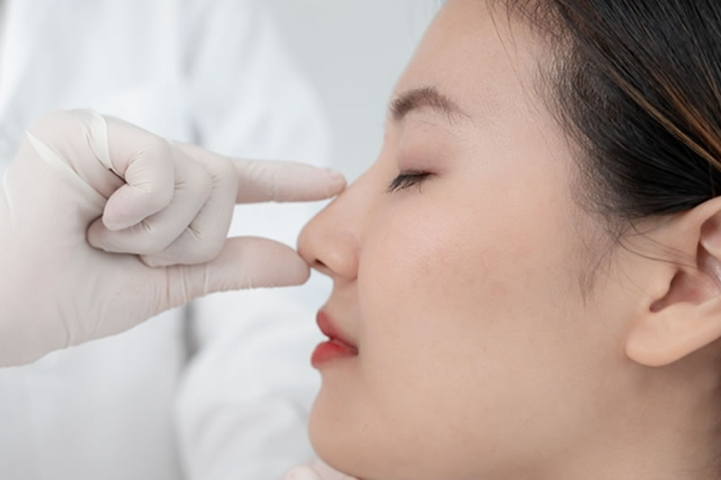 鼻尖形成の手術をする前の女性