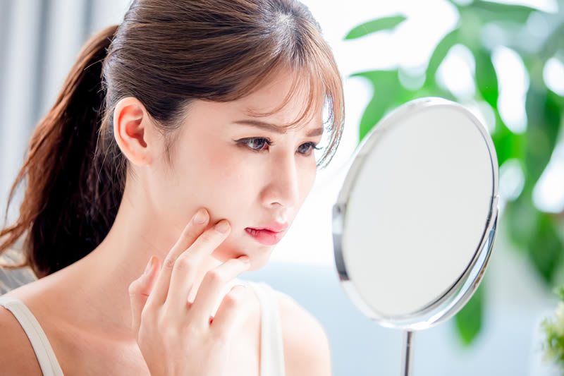 にきびを気にする女性