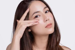 二重整形を受けた女性