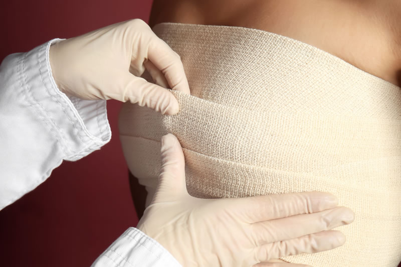 豊胸手術を受けた女性