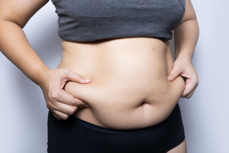 お腹に皮下脂肪が付いている女性