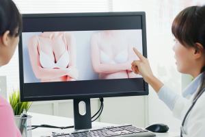 脂肪注入豊胸術のデメリットを説明する医師