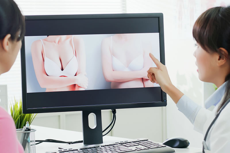 脂肪注入豊胸術のデメリットを説明する医師