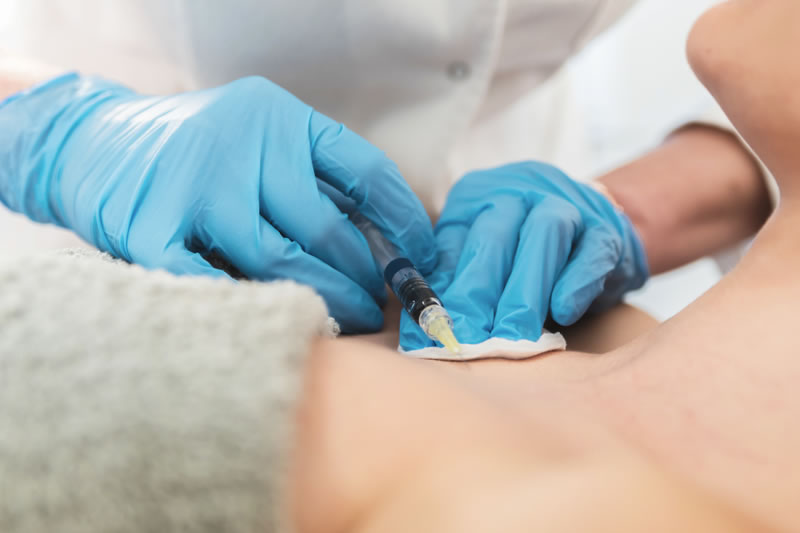 ヒアルロン酸豊胸を受けている女性