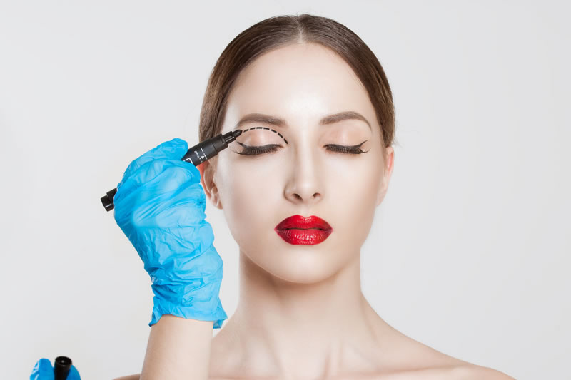 医師により全切開手術の切開ラインを描かれている女性