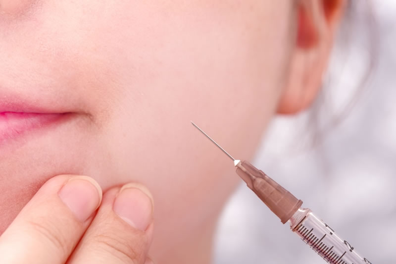 プチ整形を受けている女性