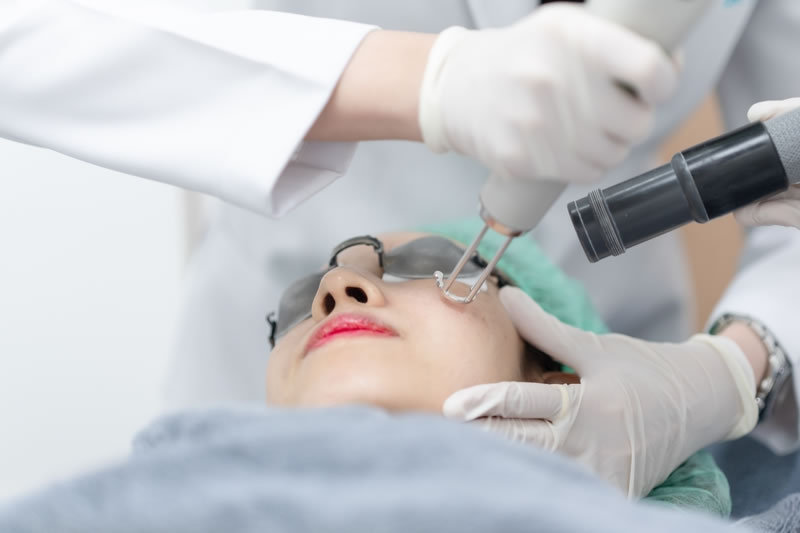 シミ取りレーザーをしている女性