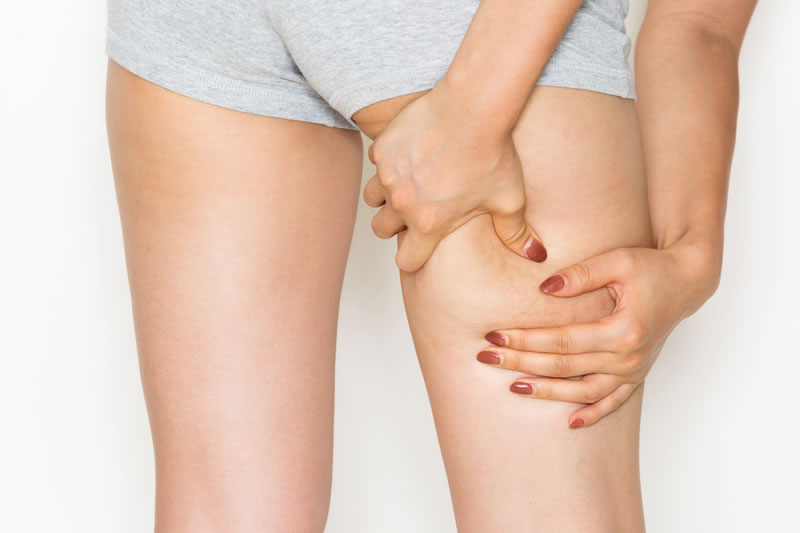 太もものダイエットをしたい女性