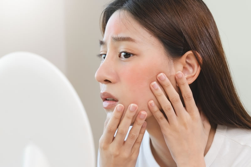 肌荒れに悩む女性