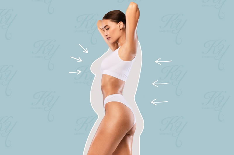 腰の脂肪吸引でスリムになった女性