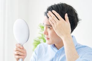 薄毛が気になっている男性