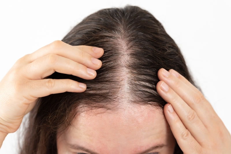 薄毛に悩む女性
