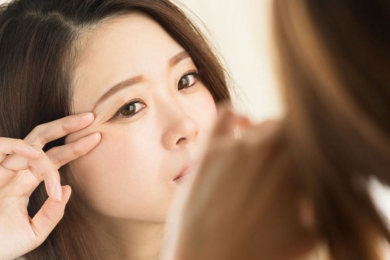 目尻の美容整形を考えている女性