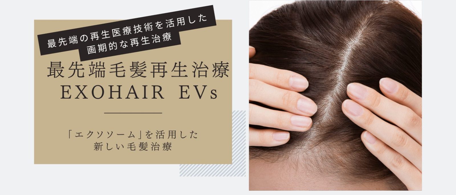 最先端毛髪再生治療 EXOHAIR EVsなら共立美容外科【公式】