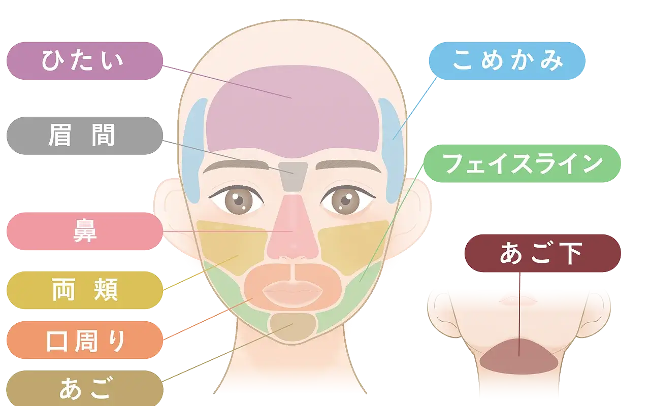 お顔の脱毛の施術部位