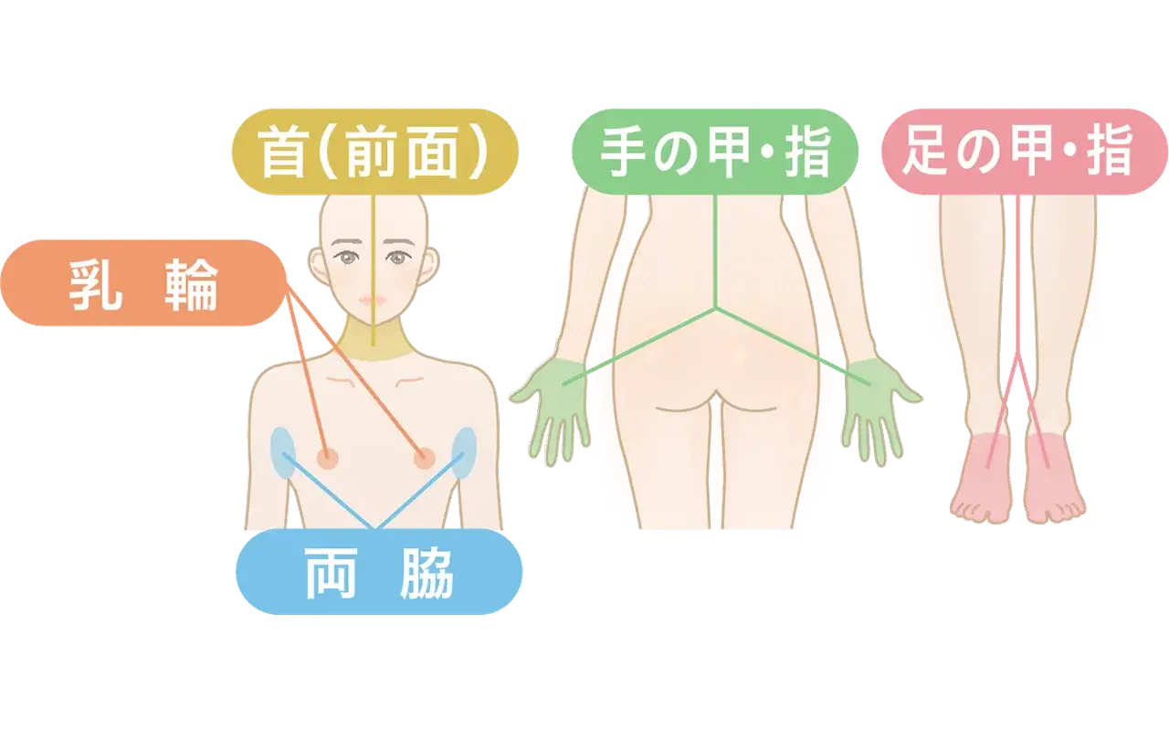 ボディの脱毛の施術部位