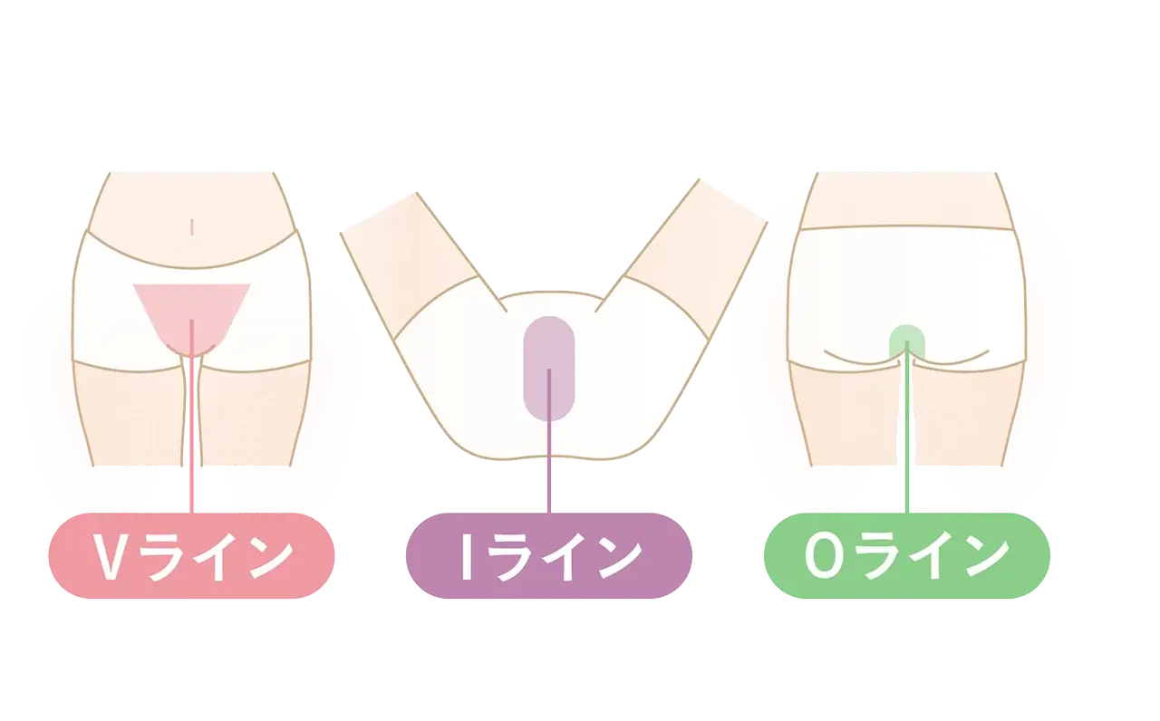 デリケートエリアの施術部位