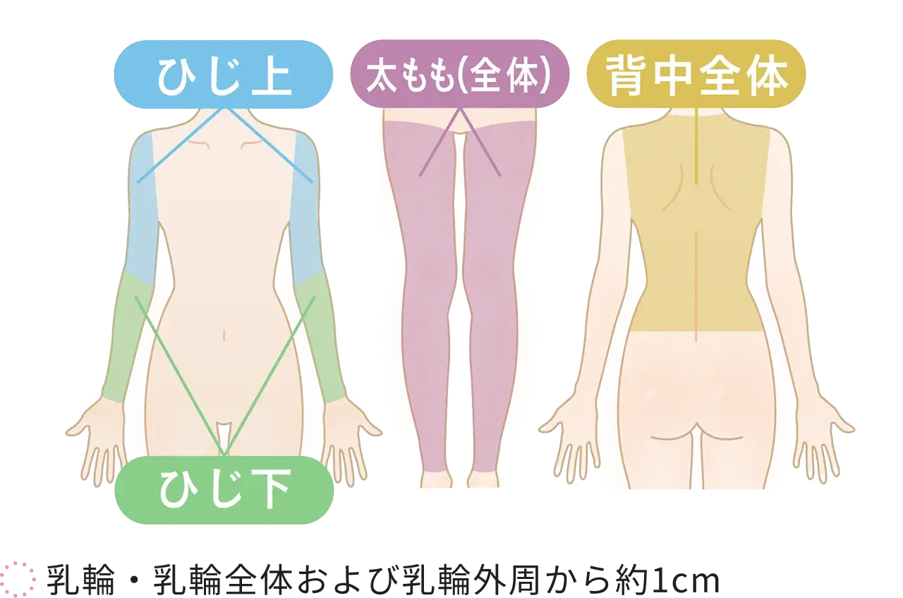 ボディの脱毛の施術部位