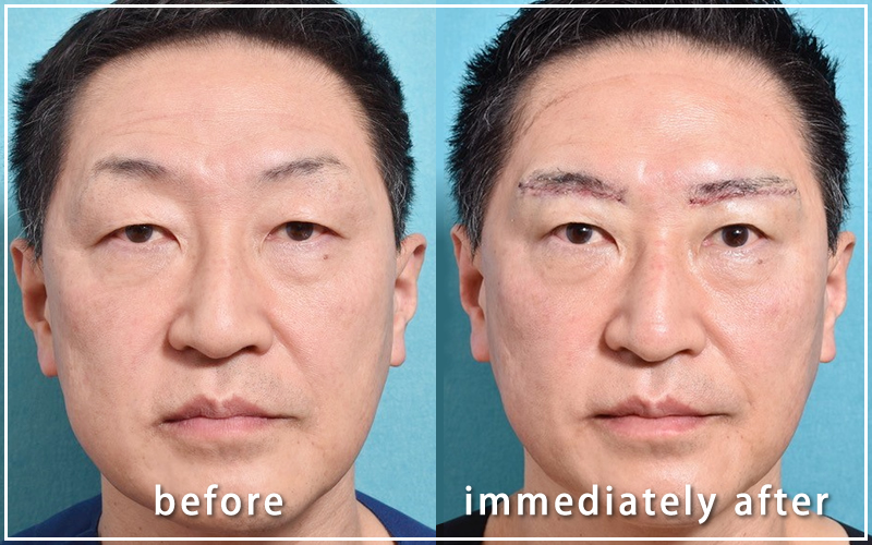 手術直後の亀井院長の写真