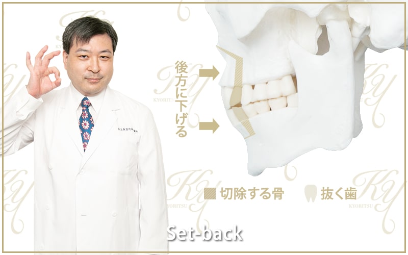 セットバック手術（上下の顎移動）を解説する浪川医師